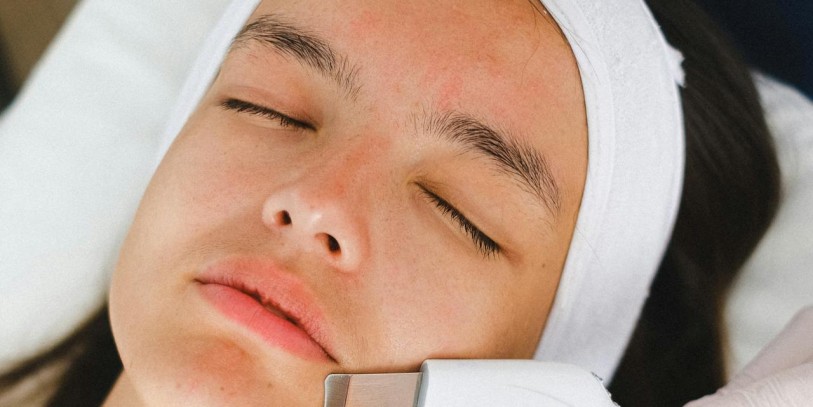 Non-Surgical Face Lift Treatments Trending in 2026