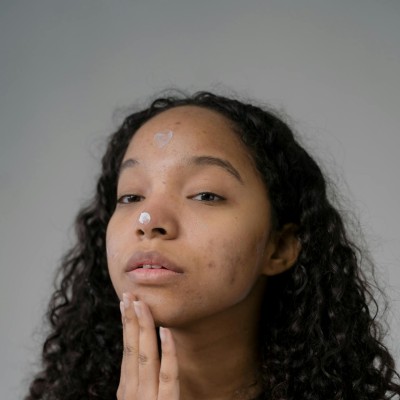 skin irritation