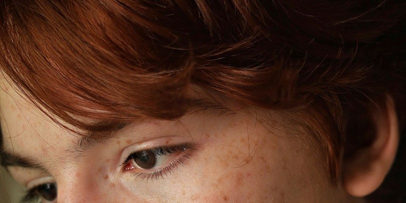 woman with red face