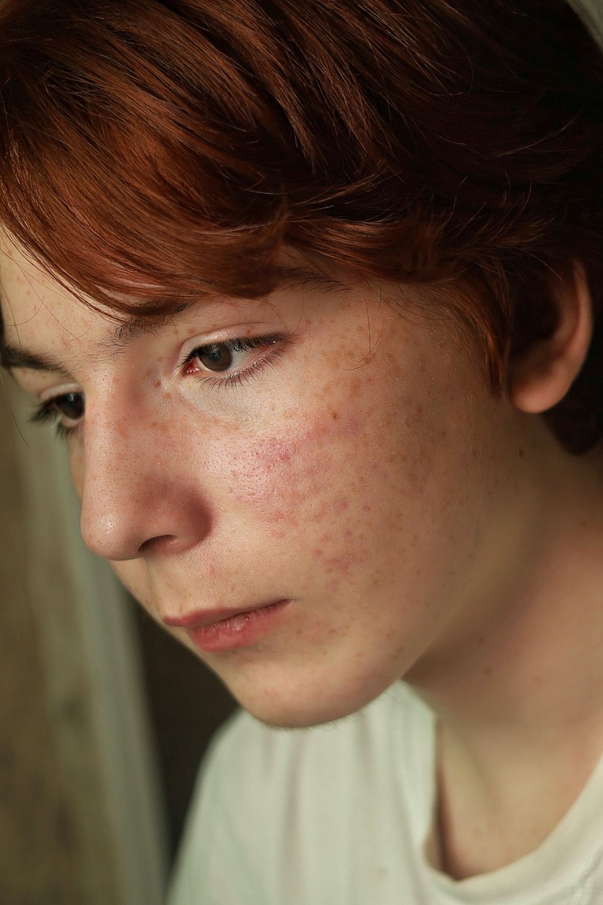woman with red face