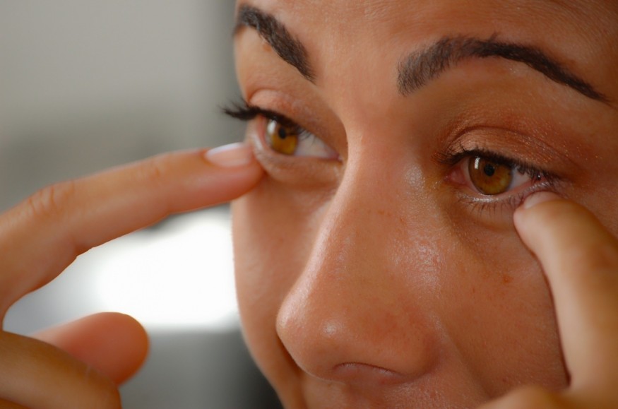 woman with dark circles