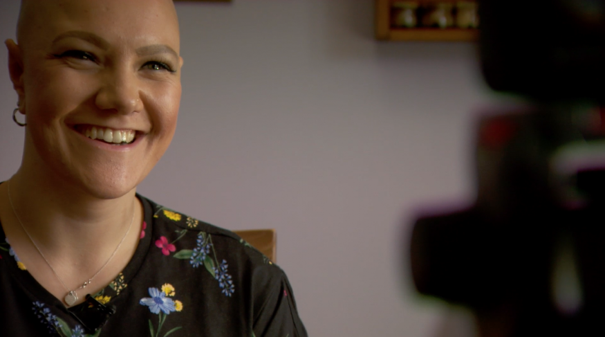 support for young people with alopecia