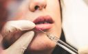 Tips On Getting Good Deals On Botox