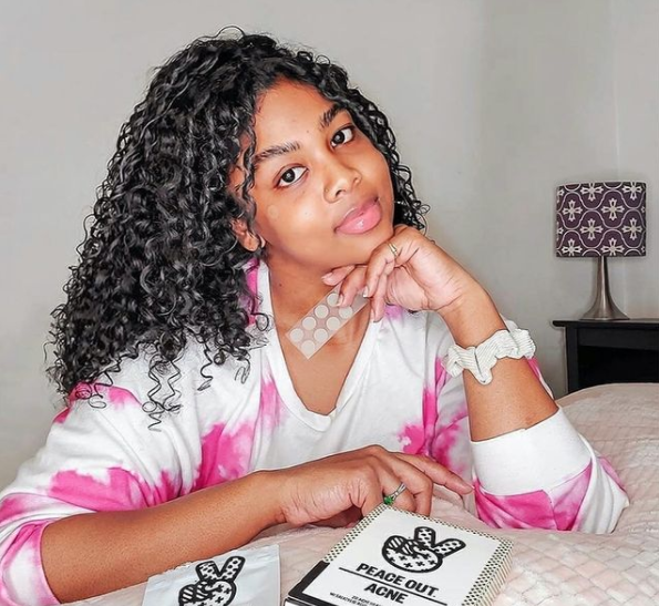 Overnight Spot Treatments to Banish Pimples Quickly