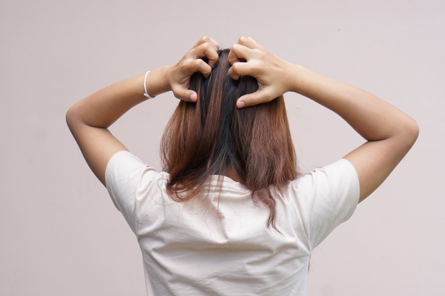 itchy scalp